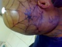 my head