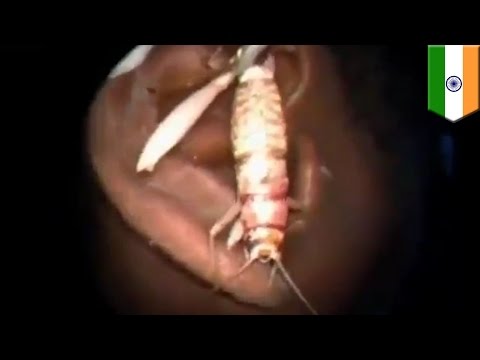 how to unclog itchy ears