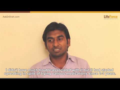how to cure oral lichen planus