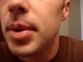VyGone Zapper Cold Sore