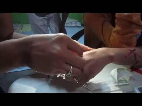 how to administer d50