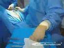 Surgical Technologists Surgical Technologists