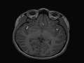 fMRI slideshow