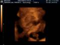 babyboy paredes4