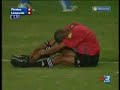 Acidente Estranho no Futebol