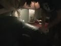 The Hand