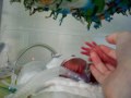 Rozthorne Crying micro preemie baby NICU 2lbs