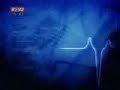 Nenad Cekic na Poligrafu pijan k'o letva