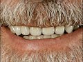 Lula - Foto Oficial - Segundo Mandato - Detalhes