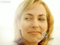 Dr Vicente Paloma Cirugia plastica Barcelona blefaroplastia parpados