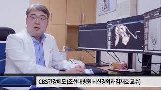 뇌신경외과 김재호 교수 - 뇌동맥류