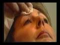 Discovery Channel interviews Dr Treacy about Botox Discovery Channel interviews Dr Treacy about Botox