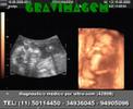 GRAVIMAGEM 11 (ultra-som de gravidez 3D 4D) GRAVIMAGEM 11 (ultra-som de gravidez 3D 4D)