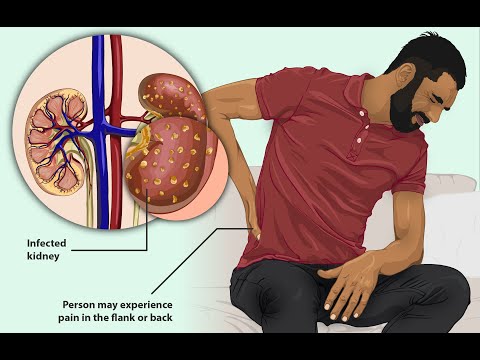 how to treat kidney failure