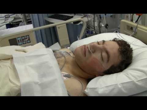 how to cure scheuermann's kyphosis