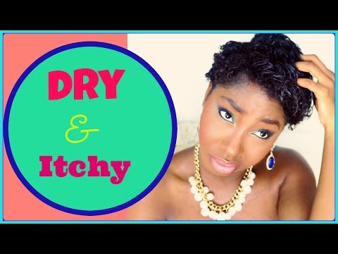 how to help itchy scalp