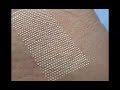 Laser skin resurfacing for acne scars removal treatment with fractional CO2 laser