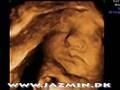 4D scan of our new baby girl