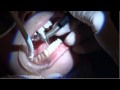 Stuff They Don't Want You To Know - Fluoridation