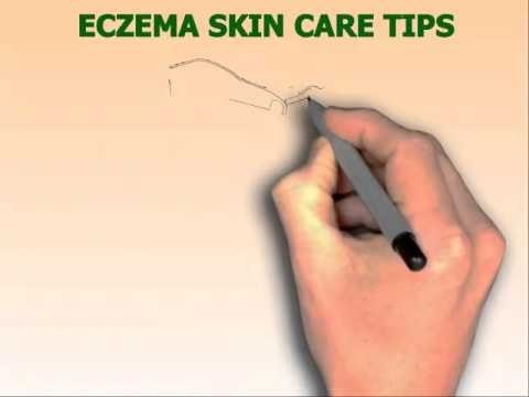 how to clear up eczema