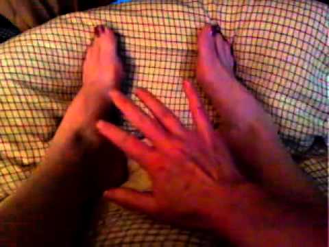 how to treat erythromelalgia