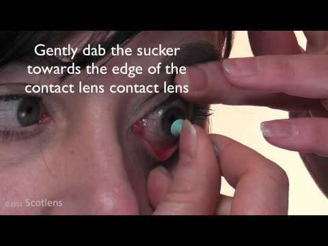 how to remove rgp contact lenses