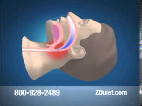 how to stop yourself from snoring
