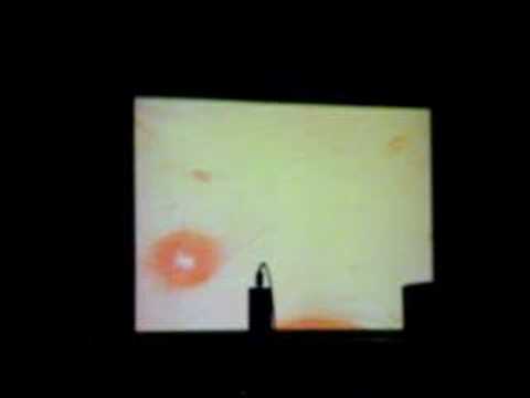 Umbilical Cord Histology