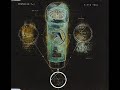 Ventolin (Crowsmengegus Mix) - Aphex Twin Ventolin (Crowsmengegus Mix) - Aphex Twin