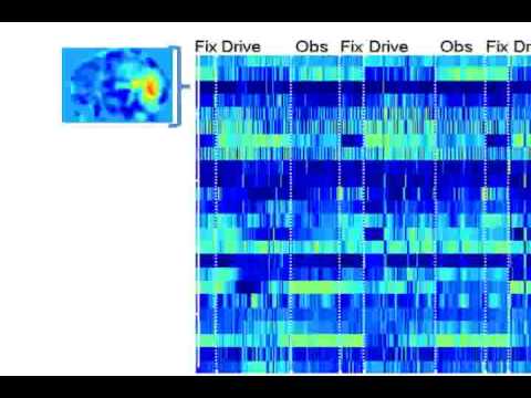 Image de prévisualisation YouTube