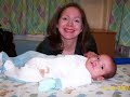 Cleft Lip & Palate Before & After 