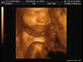 29th Week 4D Ultrasound Livia de Paula