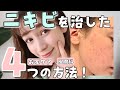 【ニキビ撃退法】今日からできるお家ケアから実際に通った皮膚科まで！