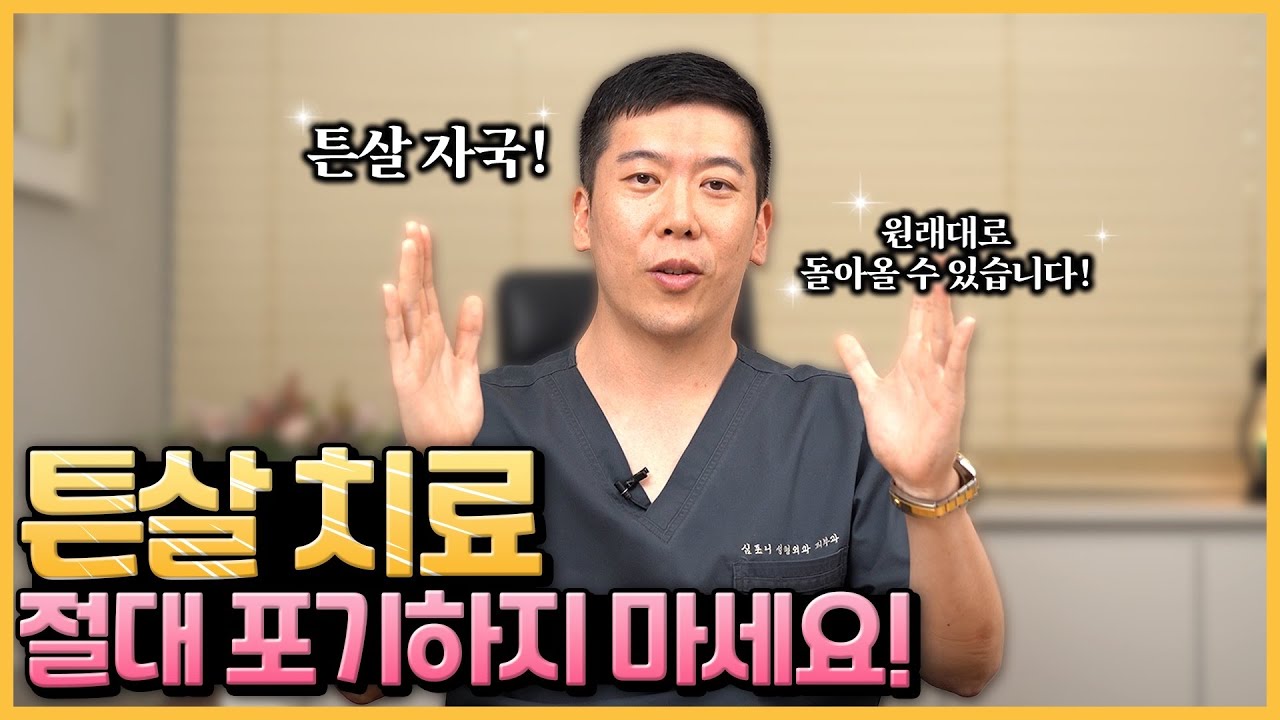 튼살 초기 치료의 중요성 : 쥬베룩볼륨과 미라젯으로 튼살 극복!