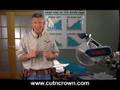 Measuring Crown Molding