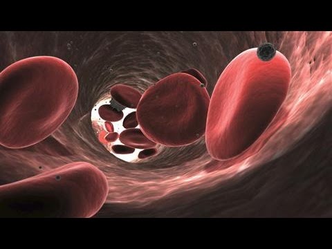 Myeloma Patients Have New Hope Thanks to New Treatments – WSJ video Myeloma Patients Have New Hope Thanks to New Treatments – WSJ video