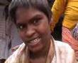 Fluorosis A Man Made Crisis