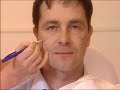 BOTOX & FILLER Treatment BOTOX & FILLER Treatment