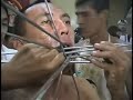 P-3 Weird Bizarre Face Piercing Spikes Shocking Asia