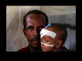 Isbitaalka Jamaame oo taqriiban 20 Mayl dhinaca waqooyi ka xigta magaalada weyn ee Kismaayo, waxaa la furay sanadkii 2007. Goobtan MSF waxay ku bixisaa nafaqayn,daryeelka dalmada, caafimaadka guud, daryeelka deg-degga ah.Haviyee Roldan oo ah Kal-kaaliye caafimaad ayaa ka soo shaqeeyay Jamame toddoba bilood sanadkan gudahiis asagoo ahaa isu-duwaha goobta. Asaga oo adeegsanayo Sawira iyo waraysiya Roldan uu la yeeshay shaqaalaha caafimaad ee Soomaaliyeed ayuu u yeelay/u huwiyay waji amba ...