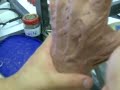 SILICON HAND LEFT BURNT