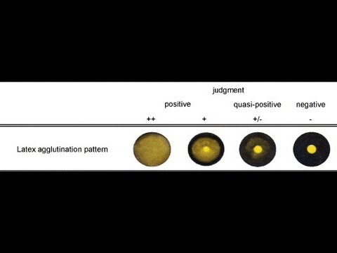 how to measure rheumatoid factor