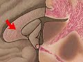How the Body Works : The Corpus Callosum