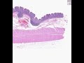 Shotgun Histology Colon