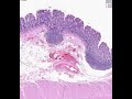 Shotgun Histology Colon