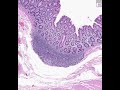 Shotgun Histology Colon