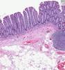 Shotgun Histology Colon