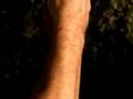 The Bees of Frogtown