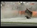 this has got to hurt!