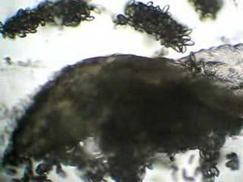 PINWORM SONG